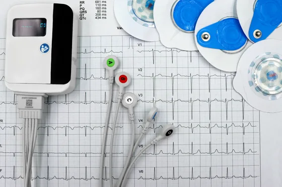 EKG kalp ritim takibi — atriyal fibrilasyon