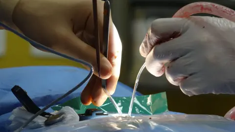 Beyin cerrahları sterile ameliyathanede