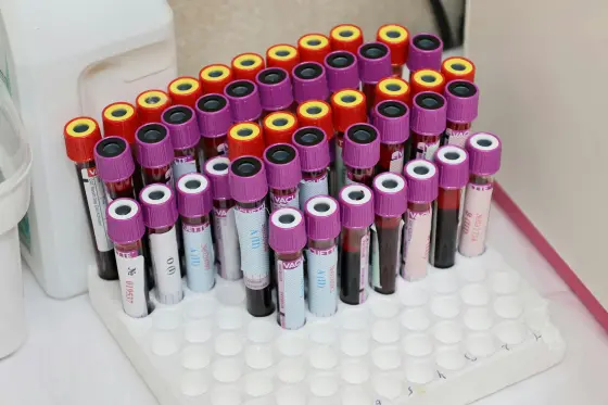 Laboratuvarda kan tüpleri — hematoloji