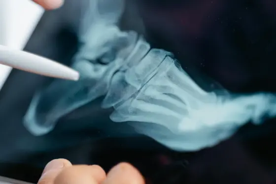 Ayak röntgeni dijital tablette — ortopedi
