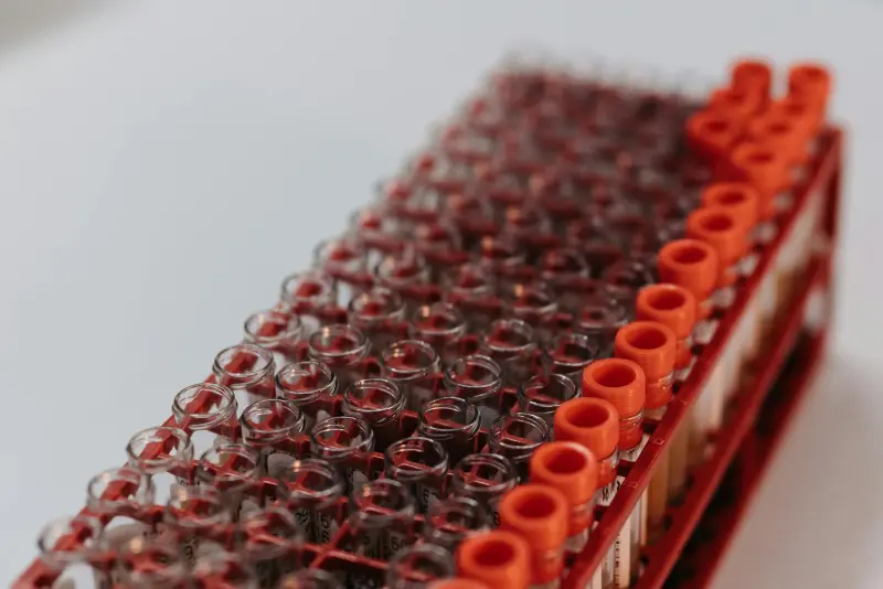 Lipid paneli laboratuvar sonuçları ve ilaç titrasyonu