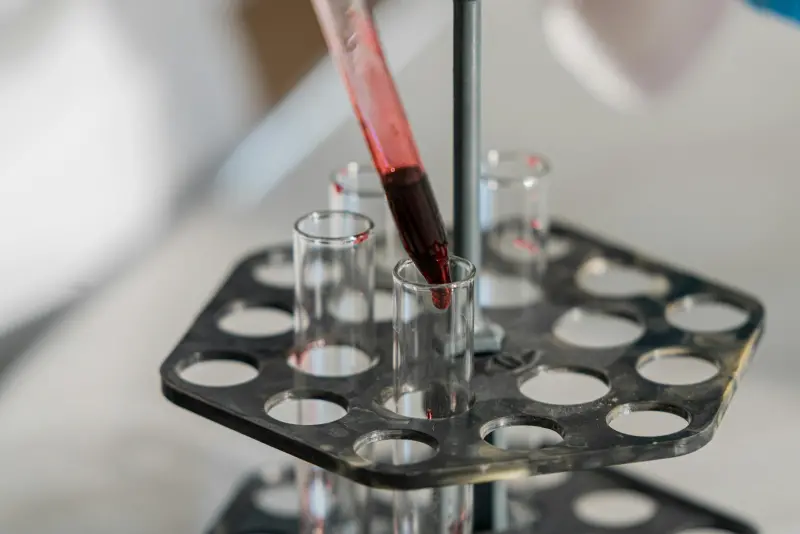 Lipoprotein(a) eşik değerleri ve aterosklerotik risk korelasyonu