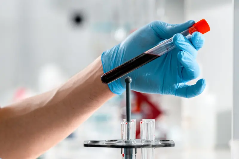Kan örneği tüpü tutan eldivenli el — PSA ve laboratuvar testleri